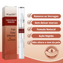 Removedor de Verrugas WipeOff™ |COMPRE 1 LEVE 3| + Frete Grátis