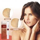 Removedor de Verrugas WipeOff™ |COMPRE 1 LEVE 3| + Frete Grátis (Oferta de Black Friday)