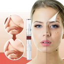 Removedor de Verrugas WipeOff™ |COMPRE 1 LEVE 3| + Frete Grátis (Oferta de Black Friday)