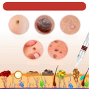 Removedor de Verrugas WipeOff™ |COMPRE 1 LEVE 3| + Frete Grátis